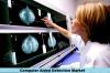 Photo for Global Computer Aided Detection Market Is Set to Boom in 2019 And Coming Years