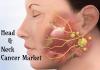 Photo for Head and Neck Cancer Market Industry 2019-2026
