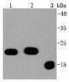 Photo for anti bax antibody