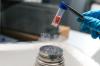 Photo for Stem Cell Banking Market  Development Industry 2018 Featuring