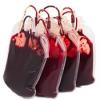 Photo for Global Blood Bags Market Manufacturers Sales Analysis Report 2019-2024