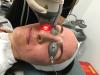 Photo for Laser Resurfacing Devices Market Shows Expected Growth from 2018-2026