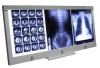 Photo for Global Industrial X-ray Film Market Manufacturers Sales Analysis Report 2019-2024