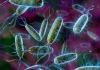 Photo for Global Microbial and Bacterial Cellulose Market Manufacturers Sales Analysis Report 2019-2024