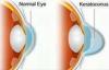 Photo for Retina Treatment in India - Ojas Eye Hospital in Mumbai