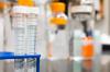 Photo for Hba1c Analyzers Market Attractiveness Matrix Outlook by 2019-2029