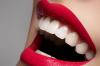 Photo for 6 Steps to a Dazzling Smile