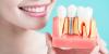 Photo for Dental Implants Market  Industry Landscape And Acknowledgement