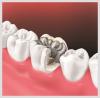 Photo for Local Washington DC Dentist for Tooth Pain