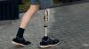 Photo for Get Yourself A Prosthetic Leg In Port St. Lucie