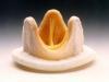 Photo for Prosthetic Heart Valve Market is Expected to Gain Popularity Across the Globe by 2026