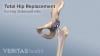 Photo for Tips to Pick the Right Doctor For Liposuction Surgery