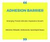 Photo for Adhesion Barrier - Emerging Trends Indicates Impressive Growth