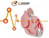 Photo for Why do cardiac biomarkers matter for myocardial infarction treatment?