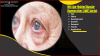 Photo for Surging Geriatric Population Driving the Wet Age-Related Macular Degeneration (AMD) Market Growth