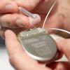 Photo for Deep Brain Stimulation Devices Market 2019 Top Comapny Profiles with Forecast Till 2024