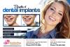 Photo for Dental Implants Kennesaw and Tucker GA