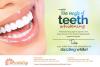 Photo for Teeth Whitening Kennesaw and Tucker GA