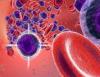 Photo for Acute Lymphocytic Leukemia Therapeutics Market Trends, Constraint and Their Impacts on Global Industry 2018-2025