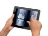 Photo for Joint Replacement and Reconstruction Products Market 2019 Top Comapny Profiles with Forecast Till 2024