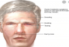 Photo for Migraine symptoms and treatments