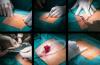 Photo for Biosurgery Equipment Market Study By Product, Application & Top Key Players – Baxter, Sanai, MAQUET Holding B.V. & Co. KG., C. R. Bard, Inc.