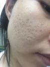 Photo for Diamond Skin Care & Cosmetic Tattoos