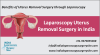 Photo for Uterus removal surgery cost in India