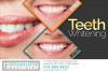 Photo for Teeth Whitening Gambrills