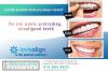 Photo for Invisalign Braces Benefits near Crofton MD