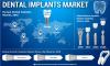 Photo for Dental Implants Market Key Players Analysis, Opportunities, Future Demand, Competitive Analysis  Forecast till 2026