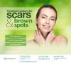 Photo for Laser Resurfacing Akron - Mayfield Heights - Mentor OH - Brown Spots