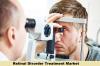 Photo for Retinal Disorder Treatment Market Report 2019-2026 | Latest Trend, Growth & Forecast