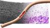 Photo for Small-Sized Vascular Graft Market Top Comapny Profiles Till 2022