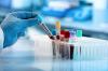 Photo for Cord Blood Banking Services Market Expected To Fuel Industry Growth With A CAGR Of 11.9% Through 2025