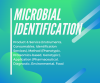 Photo for Microbial Identification Market – Top 3 Players and there Market Growth