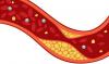 Photo for Best Meal Plan to Reduce Cholesterol