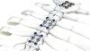 Photo for Sternal Closure Systems Market Hit at a CAGR of 5.4% In Terms Of Revenues from 2018 to 2025