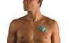 Photo for Arrhythmia Monitoring Devices Market to Witness Soaring Growth During the Forecast Period
