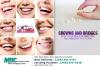Photo for Dentist office near White Lake Charter Township MI - crowns and bridges