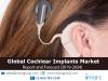 Photo for Cochlear Implants Market: Global Size, Share, Trends, Analysis, Growth & Forecast to 2019-2024