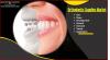 Photo for Orthodontic Supplies Market to See Strong Growth and Business Opportunities