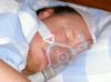 Photo for Sleep Apnea Devices Market Analysis On The Basis Of Product ,Region And Forecast To 2025