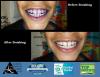 Photo for dentist