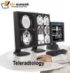Photo for How have AI and Teleradiology transformed medical industry?
