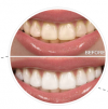Photo for best dentist in thiruvalla