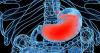 Photo for Gastroesophageal Reflux Disease Therapeutics Market is projected to grow moderately at 2.9% CAGR through 2025