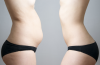 Photo for Medical Weight Loss Philadelphia