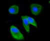 Photo for anti ubiquitin antibody