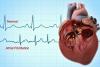 Photo for Atrial Fibrillation Market Is Expected To Reach USD 16.17 Billion By 2020